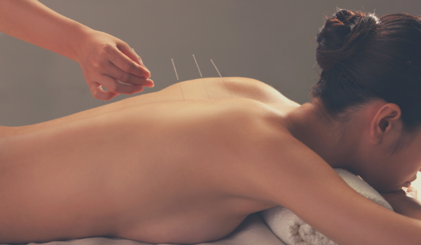 femme traitement acupuncture